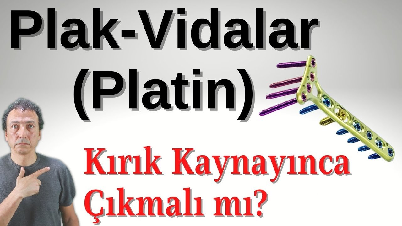 İMPLANTLAR KIRIK KAYNAYINCA ÇIKARTILMALI MI?