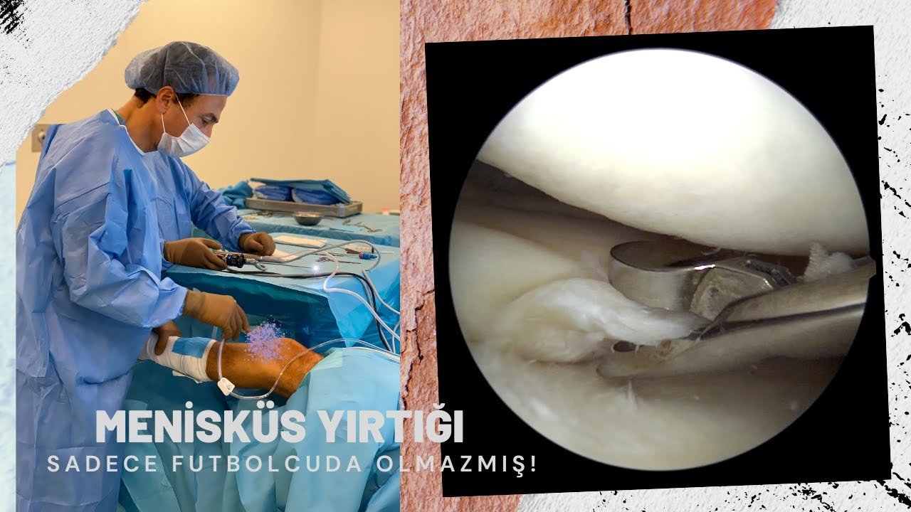 Menisküs Yırtığı? Futbolcuda Olmaz Mıydı?